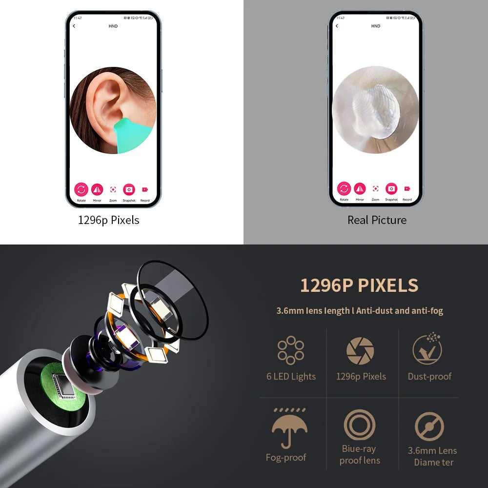 Smart Ear Cleaner with Camera